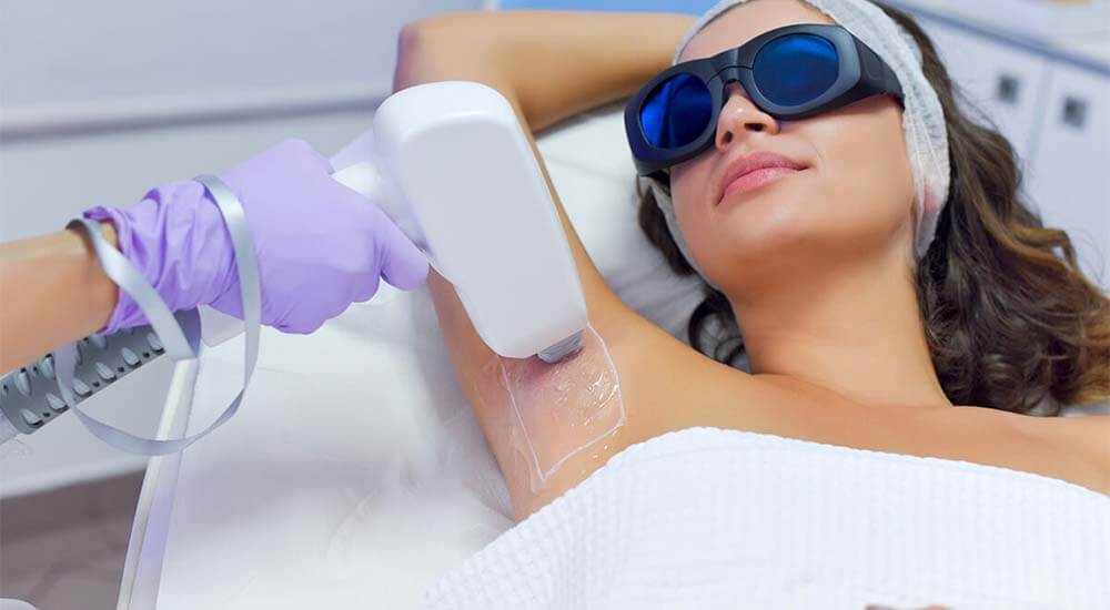 Yüz Lazer Epilasyon